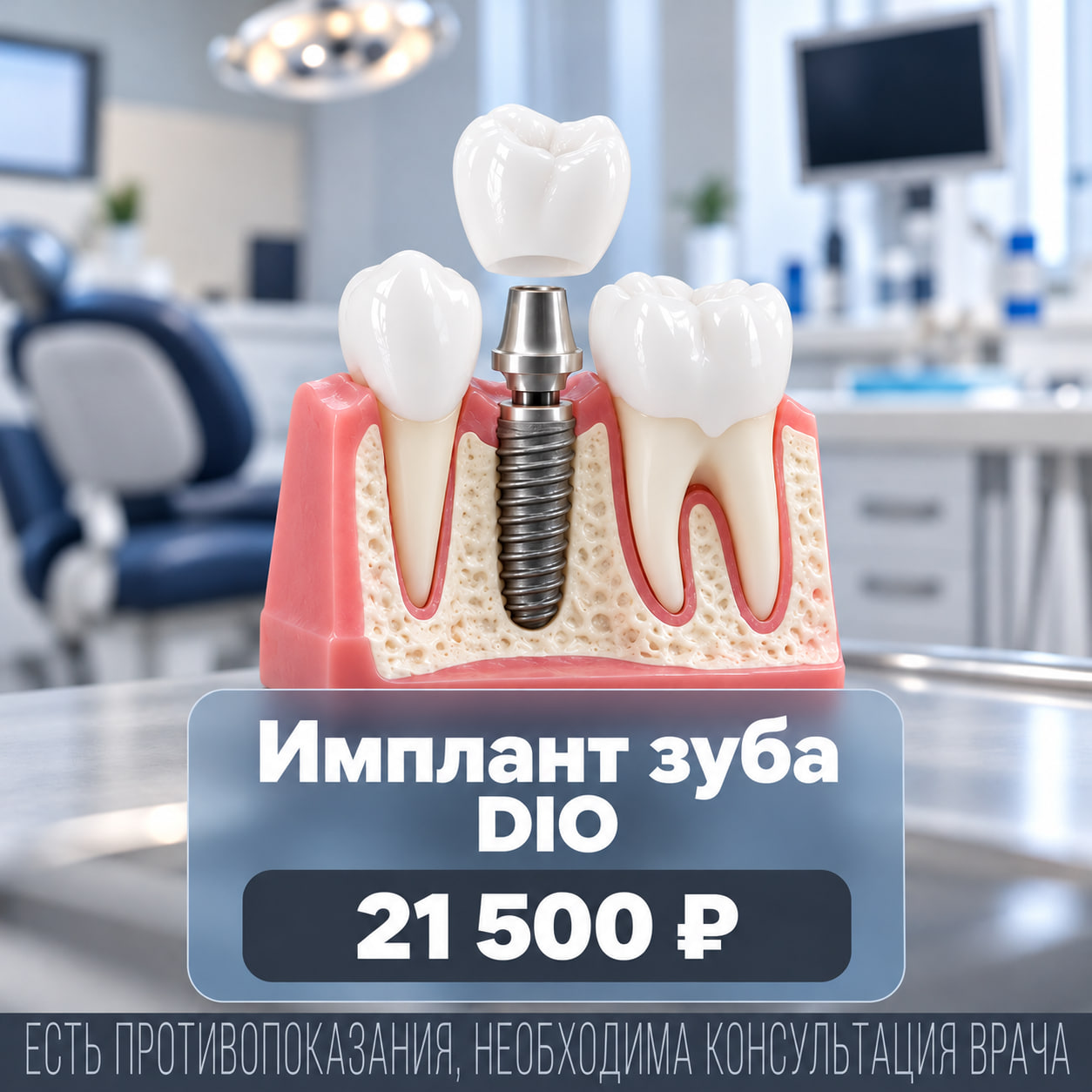 Имплант зуба DIO по специальным ценам